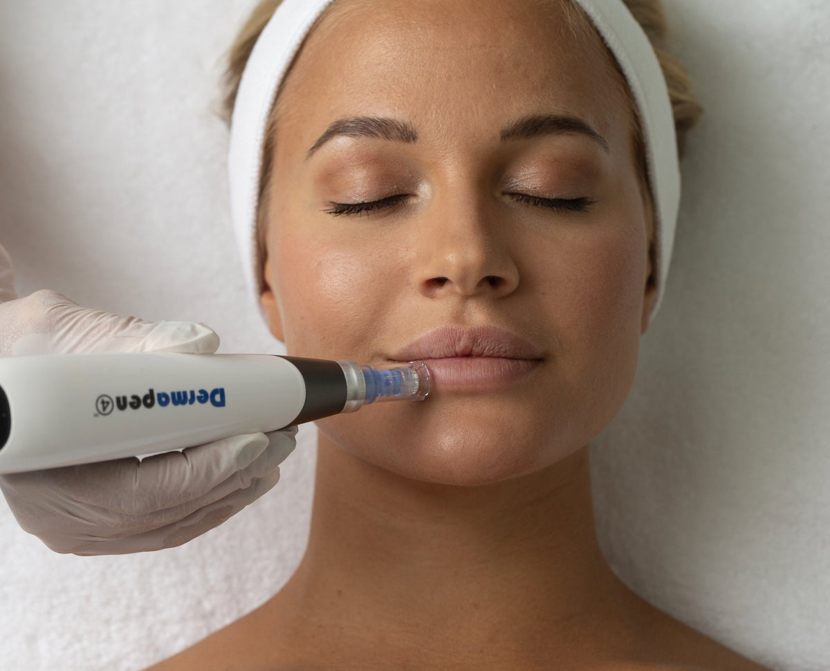 Dermapen Treatment Sessions
