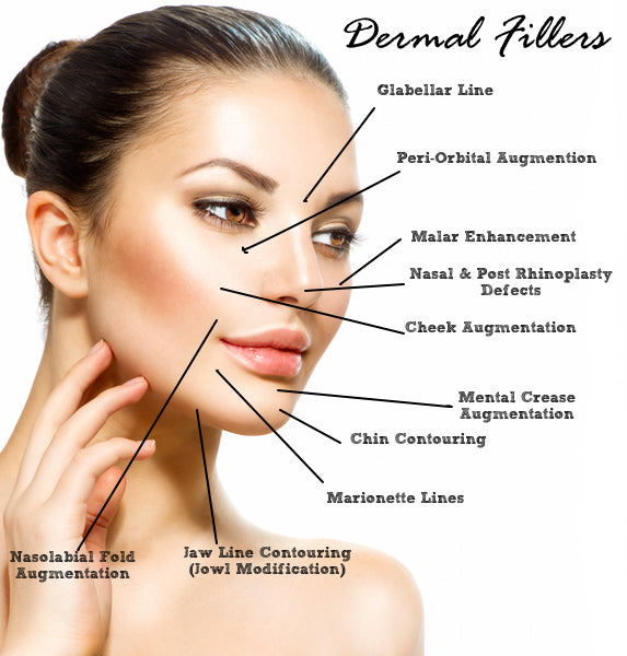 Fillers ( Juvederm / Restylane & Belotero)