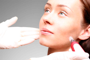 Facial Rejuvenation Treatment (PRP/PRF)